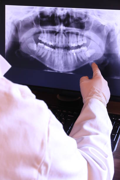 Best Emergency Treatment for Dental Infections or Abscesses in Westview, FL
